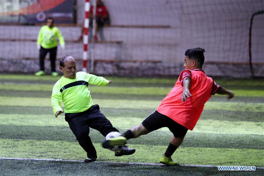 (SP)EGYPT-ALEXANDRIA-FOOTBALL TEAM-PEOPLE SUFFERING FROM DWARFISM